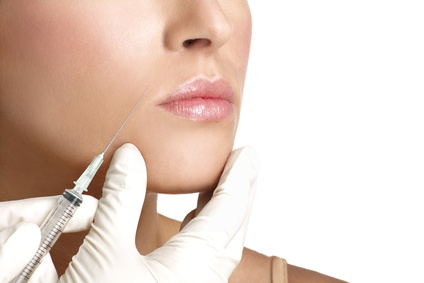 Dermal Fillers - Smile lines Dermal Fillers - Smile lines