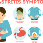 Chronic gastritis