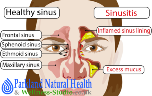 Enteroptosis - abnormal downward displacement of the intestine