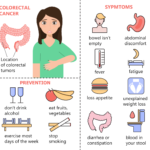 Colon Cancer Symptoms: Signs & When to See a GP