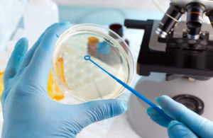 Oncology: intestinal cancer