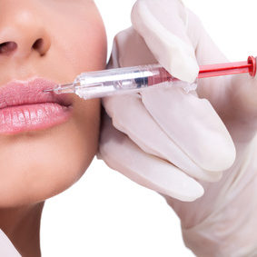 Lip correction or augmentation with dermal fillers
