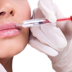 Lip correction or augmentation with dermal fillers
