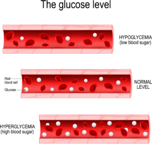 Hypoglycaemia is low blood sugar
