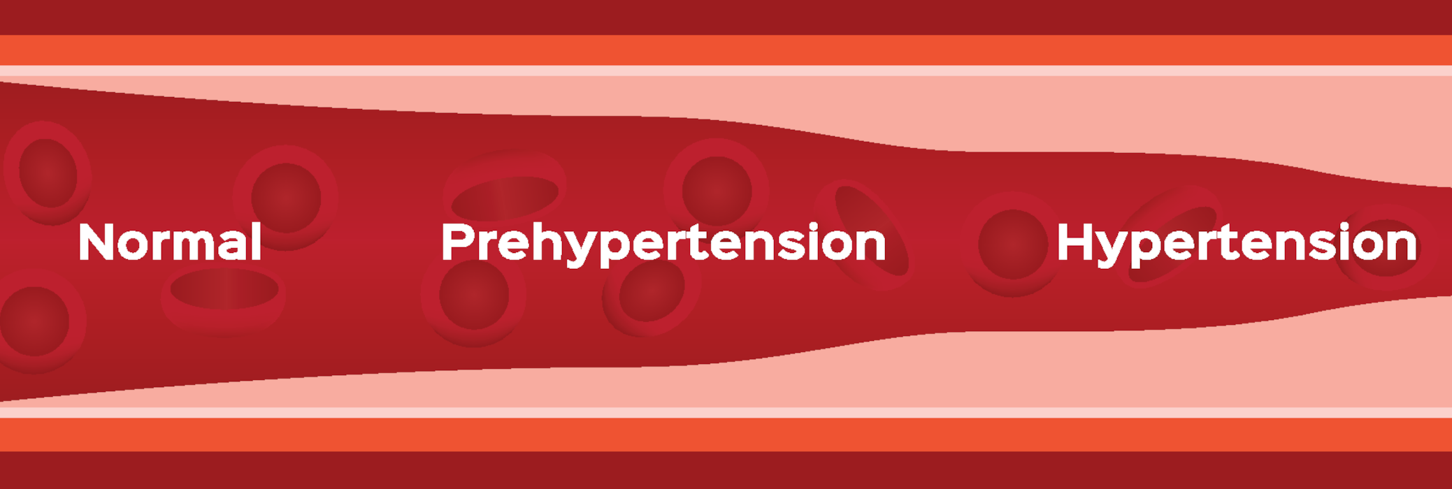 Hypertension factors - high blood pressure
