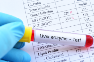 What tests should be done in case of bowel cancer?